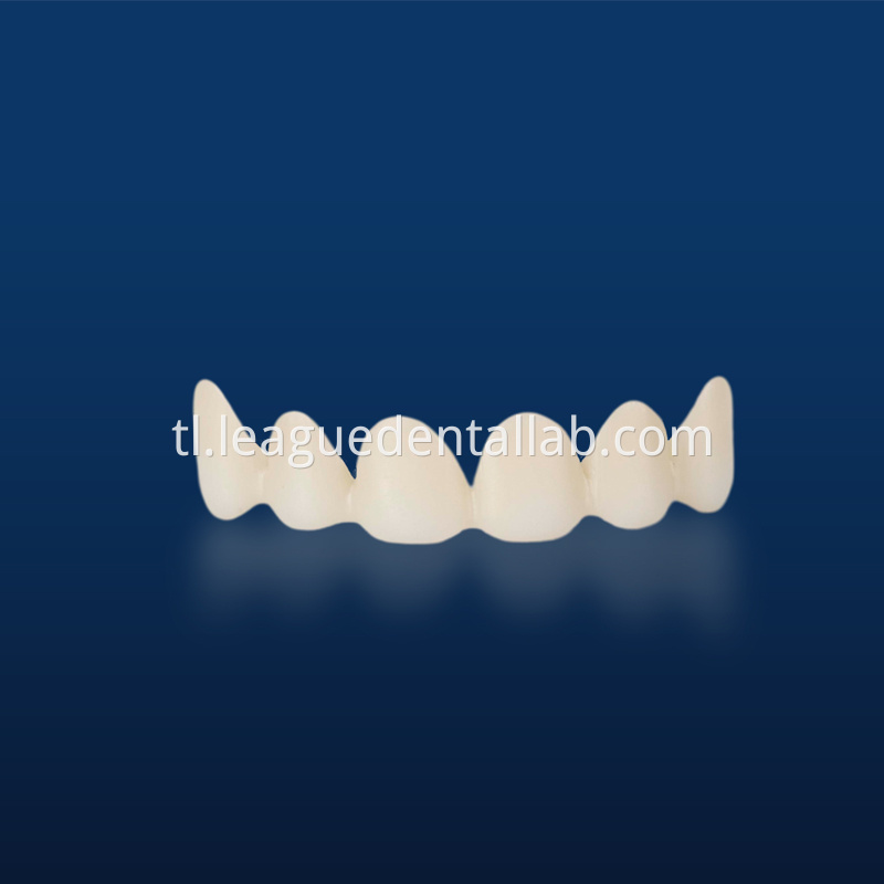 PFZ,Porcelain Fused to Zirconia,Zirconia Layered, Zirconia Veneered